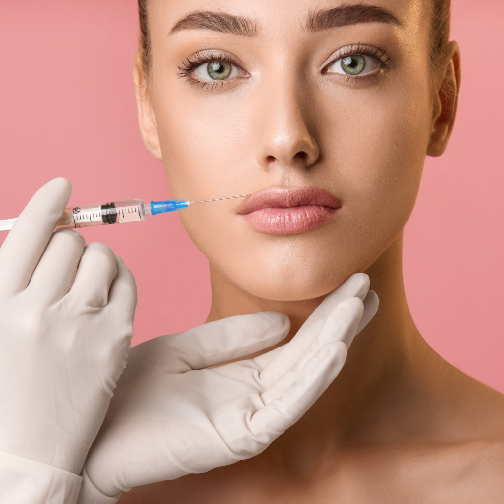 Lip Fillers using Russian Lip technique