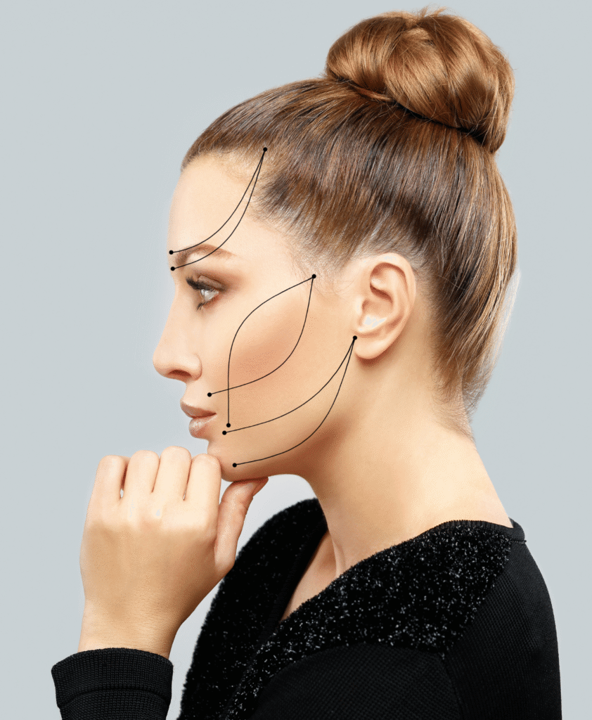Thread Lift Face Contouring