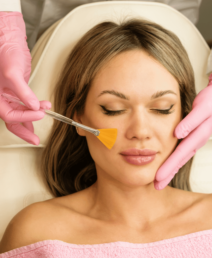 The Science Behind Effective Chemical Peel