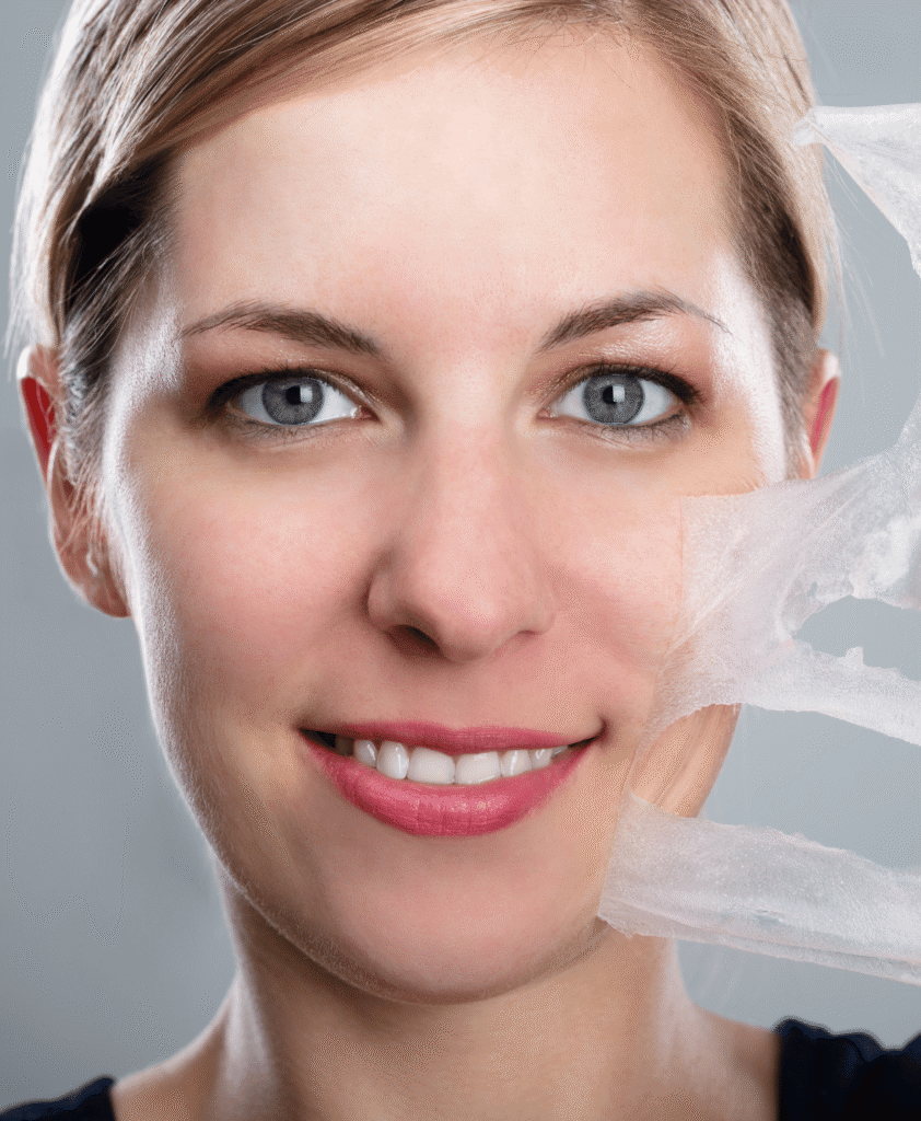 Not Sure Which Chemical Peel You Need?