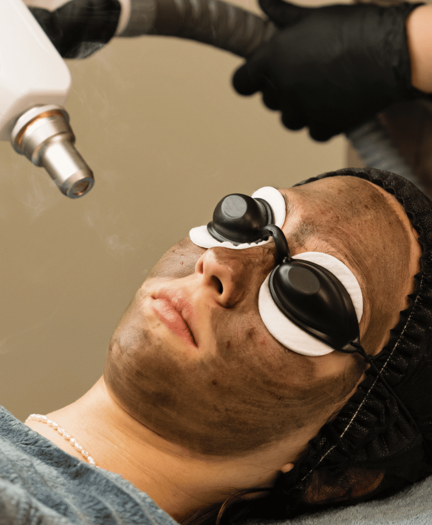 Medium-Depth Peels: Structural Improvement