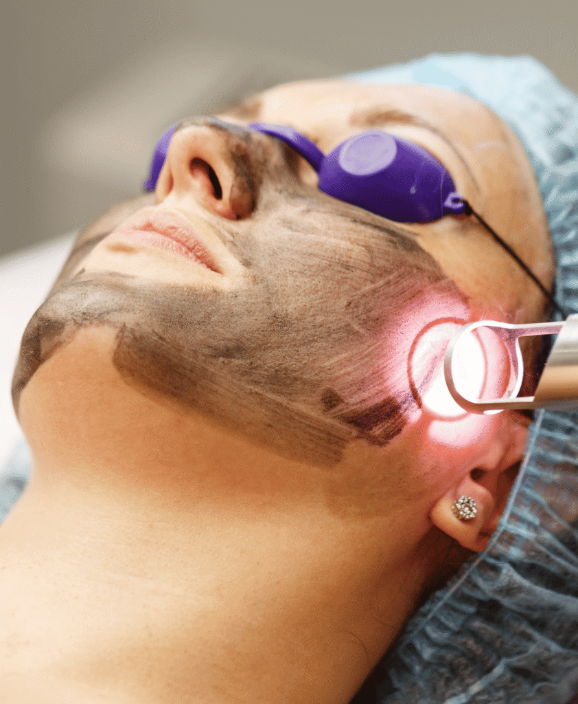 Your Chemical Peel Experience at Aesthetic Clinic Dubai