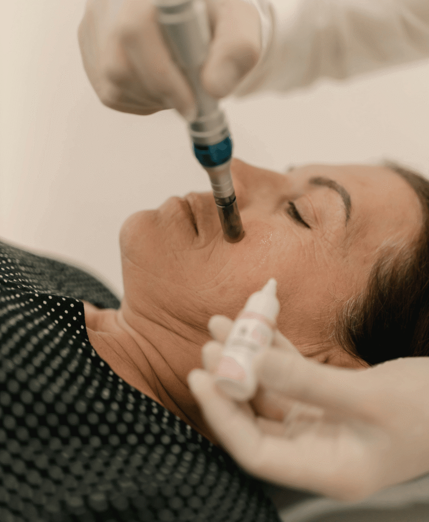 SilkPeel Microdermabrasion – 45 Minutes to Silky Perfection